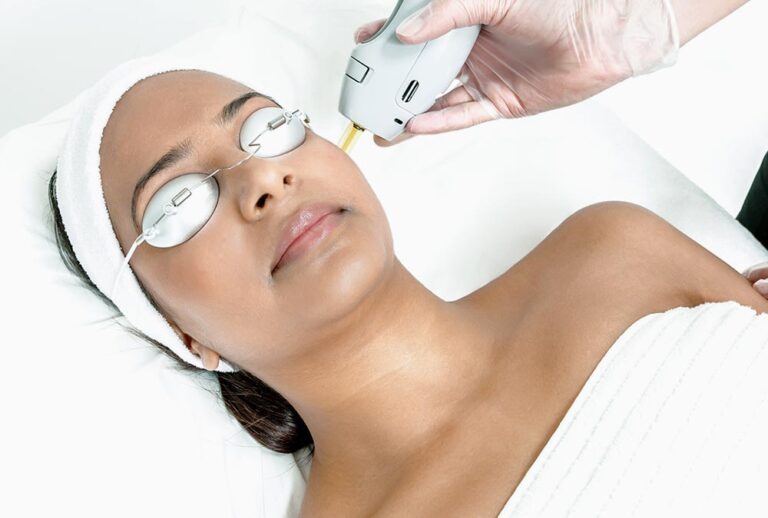 Candela Treatment